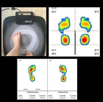 semelle orthopédique sur-mesure